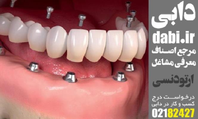 متخصص ارتودنسی شمال تهران Image